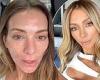 Nadia Bartel reveals her red and bumpy face after having an allergic reaction ... trends now