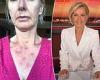 Deborah Knight, 50, reveals painful-looking welts on her chest following skin ... trends now