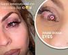 Jesy Nelson reveals she is suffering with an eye infection trends now