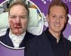 Dan Walker looks well at Ultimate News Quiz after bike crash left him with ... trends now