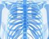 NHS surgeons use high-tech 3D printers to create replacement ribs for cancer ... trends now