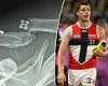 sport news Graphic image: St Kilda AFL star Jack Steele plays on against Bulldogs despite ... trends now