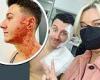 Coronation Street behind-the-scenes snaps show Ryan's gruesome injuries after ... trends now