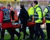 sport news Yeovil striker Alex Fisher suffers HORROR ankle injury trends now