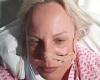 Woman, 45, had to have emergency surgery after doctors failed to spot 'red ... trends now