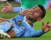 sport news Matheus Nunes suffers gruesome finger injury during Man City's win over ... trends now
