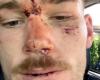 Two NSW police officers plead not guilty over alleged assault of NRL star Tom ...