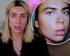 Social media star Kurt Coleman reveals he regrets getting lip filler at the age ... trends now