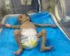 Just skin and bone: The starving Gaza toddlers kept in incubators as UN human ... trends now