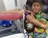 sport news GRAPHIC IMAGE: Raiders star Albert Hopoate reveals extent of his severely ... trends now