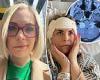'The tumors will never stop... I just want my face back': Woman, 32, born with ... trends now