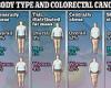 The body types that raise the risk of colon cancer - which is rising rapidly in ... trends now