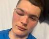 Manchester City fan, 14, suffered 'devastating' 15ft fall onto concrete while ... trends now