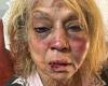 Girrawheen bashing: Elderly woman allegedly battered unconscious in home ... trends now