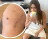 Sofia Vergara, 51, shares grisly photo of the scar on her knee from 'major' ... trends now