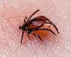 Thousands in West Virginia struck down by 'mystery' tick-borne disease that's ... trends now