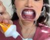 Dentist reveals the two common brushing mistakes that turn your teeth yellow trends now