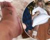 Britney Spears cries as she updates fans on her swollen ankle... as its ... trends now